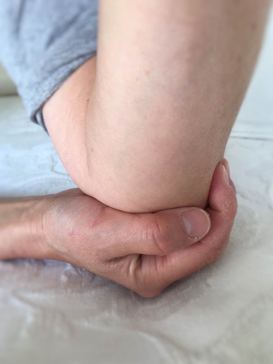 Laoli_Vital_Sehne-Tennisarm-Tennisellbogen_Symptome-Lösung